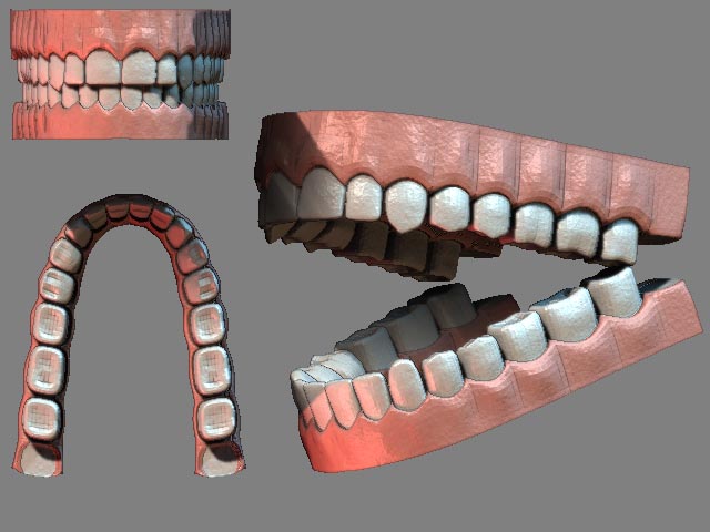teeth2.jpg