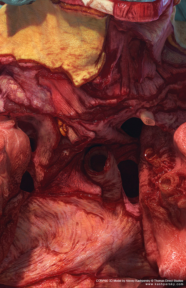 corpse_f9.jpg