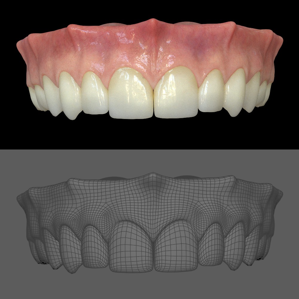 Teeth1_result
