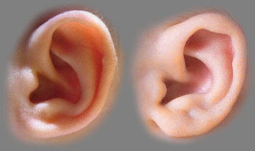 babies_ears.jpg