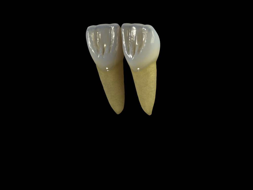 dientes2.jpg