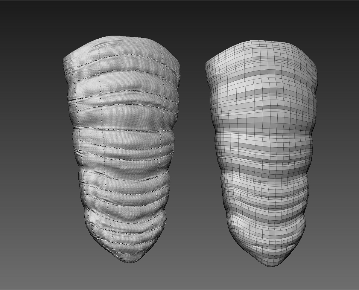 Abdomen.jpg