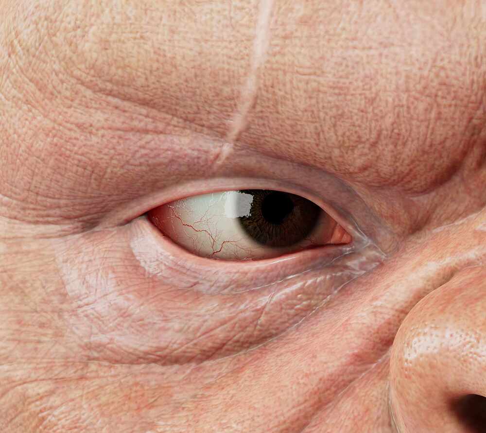 wip eye 4