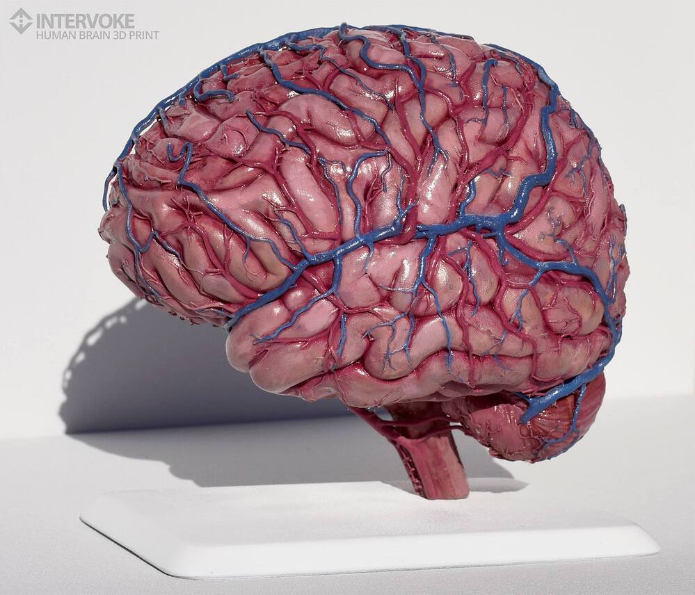 Intervoke_brain 3d print02