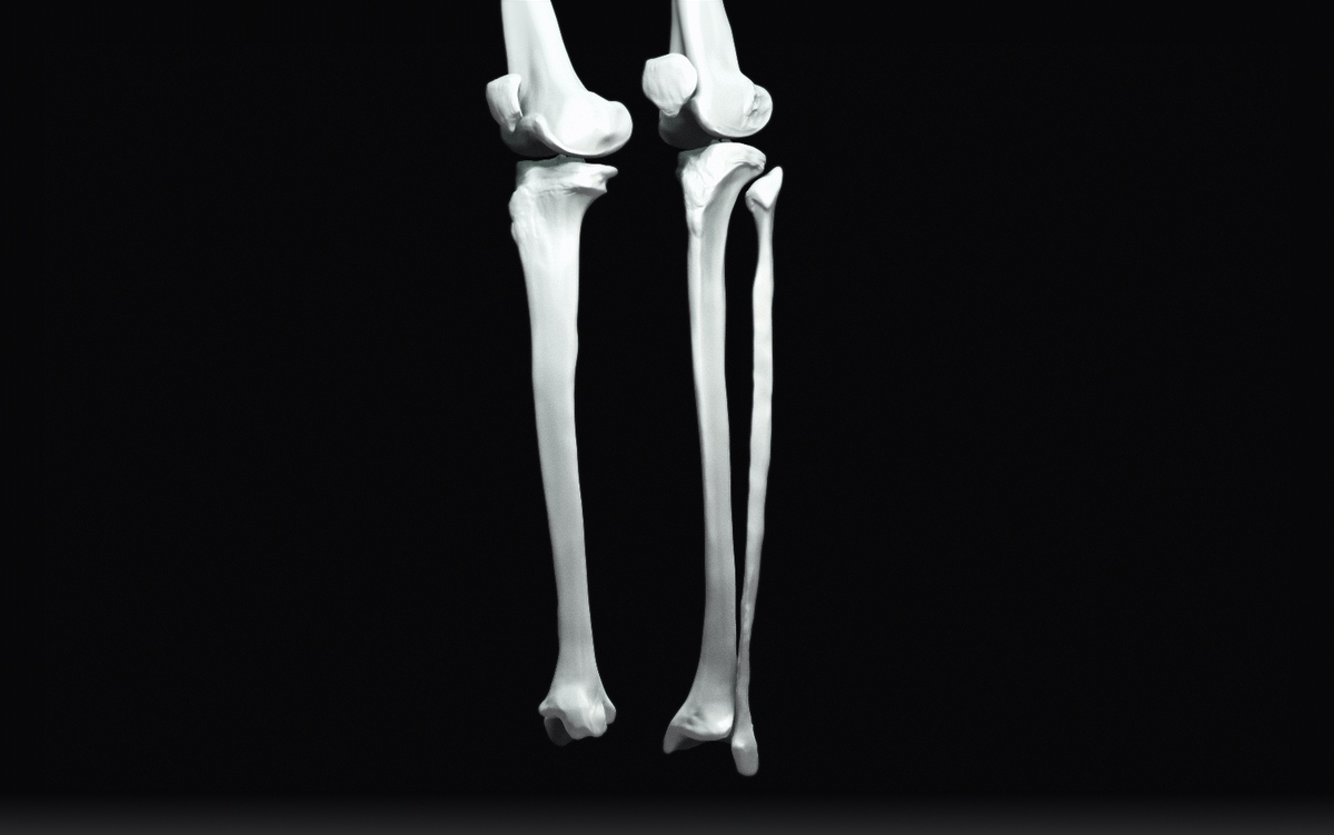 Fibula1