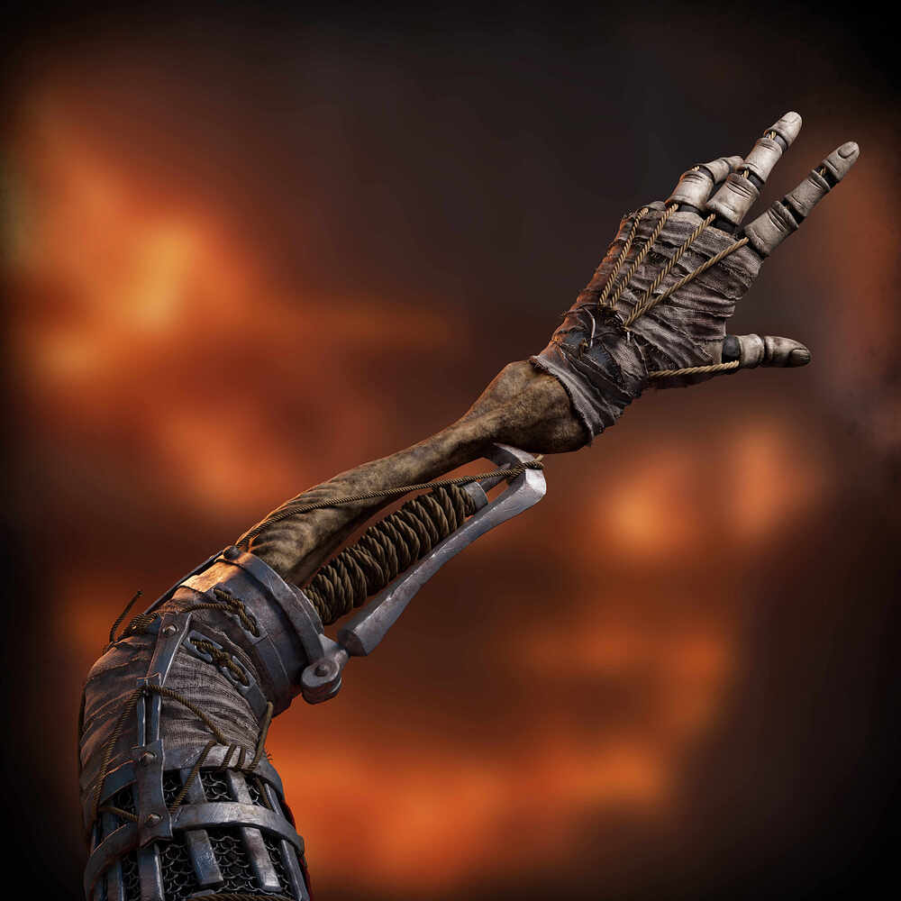 Prosthetic1