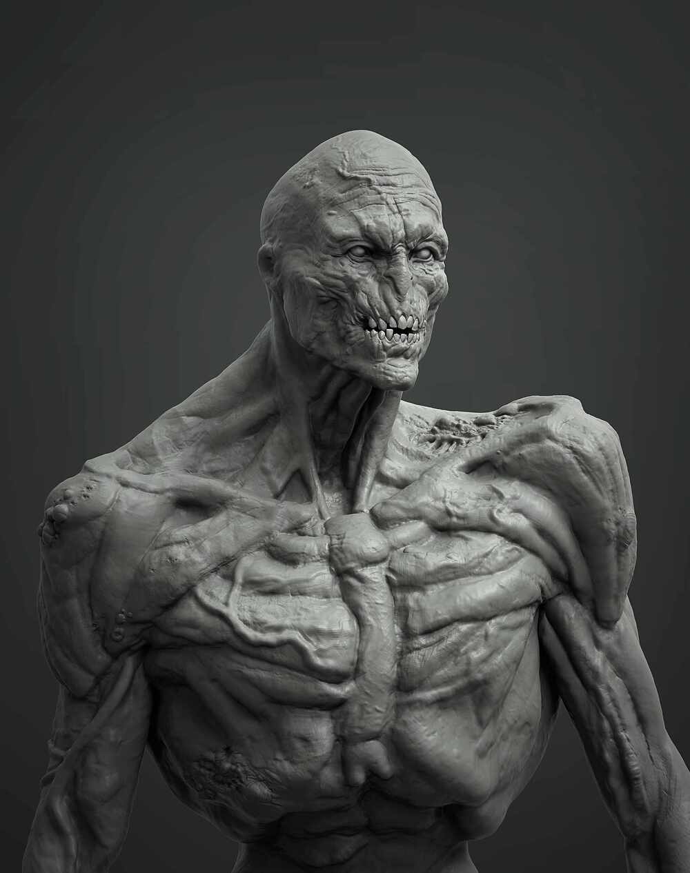 body_00