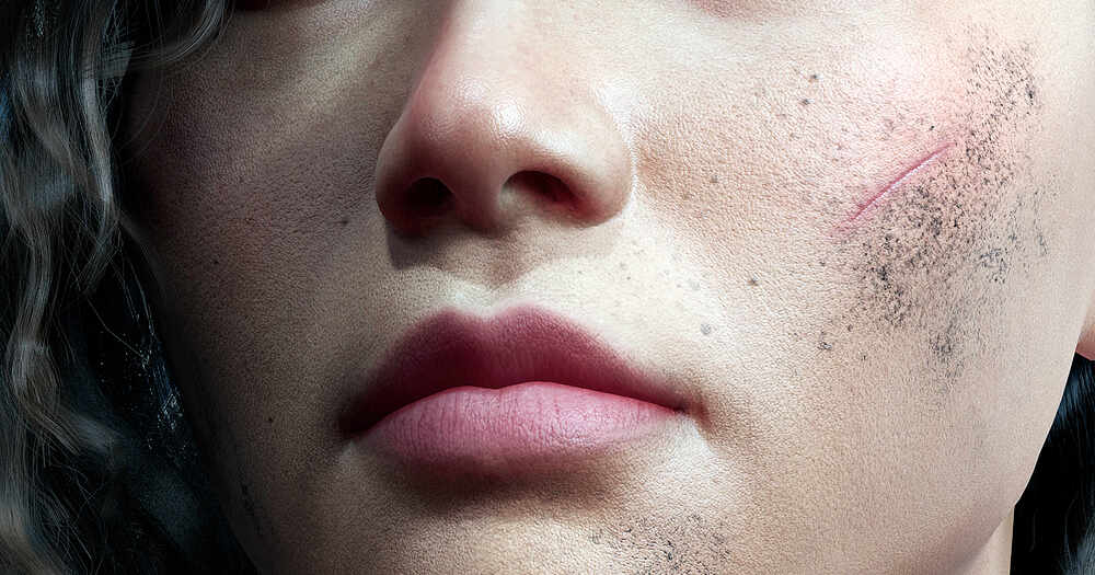 9