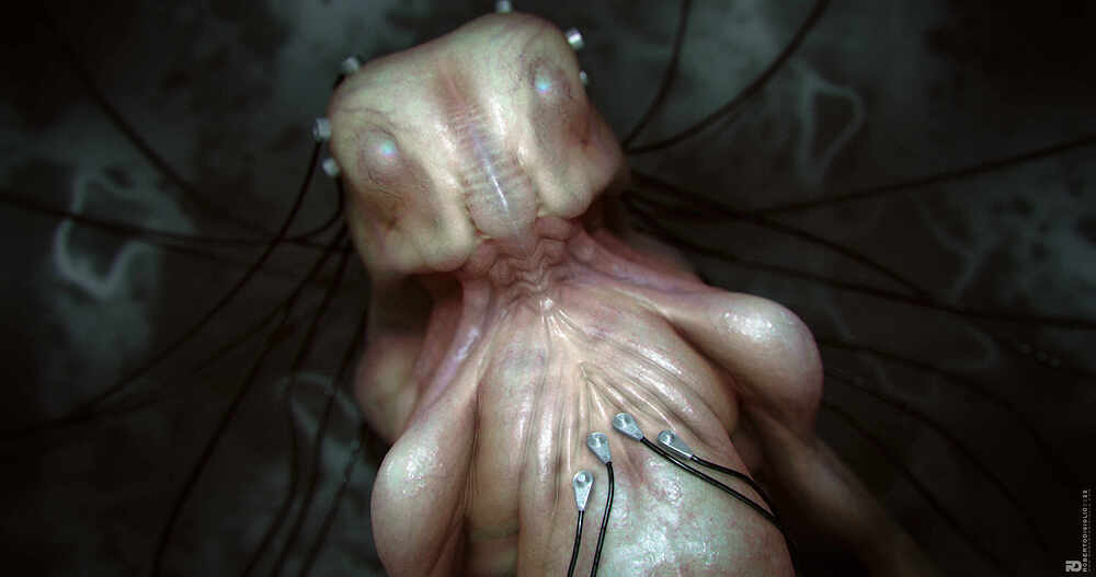 Fetus_1