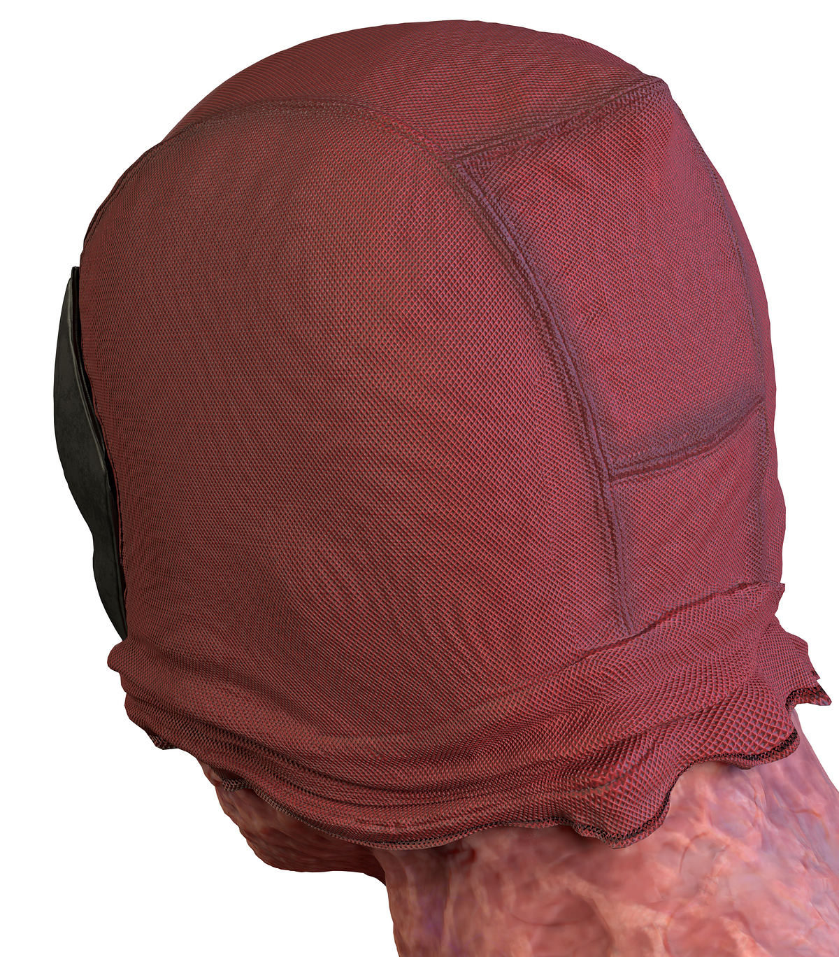 backdetail