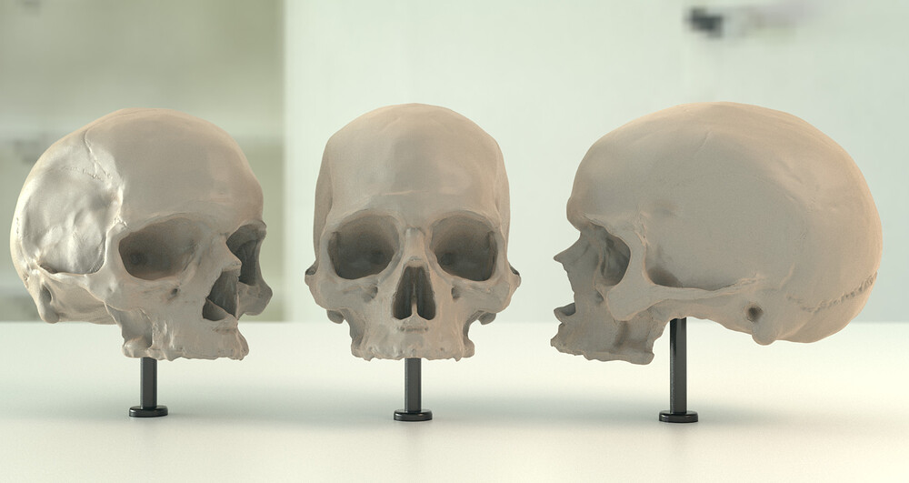 skull