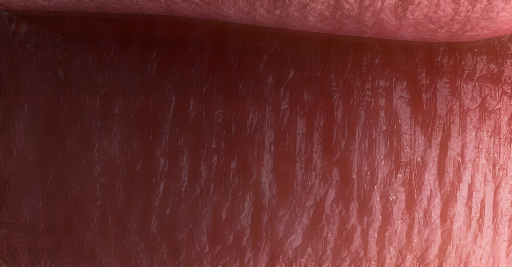 47