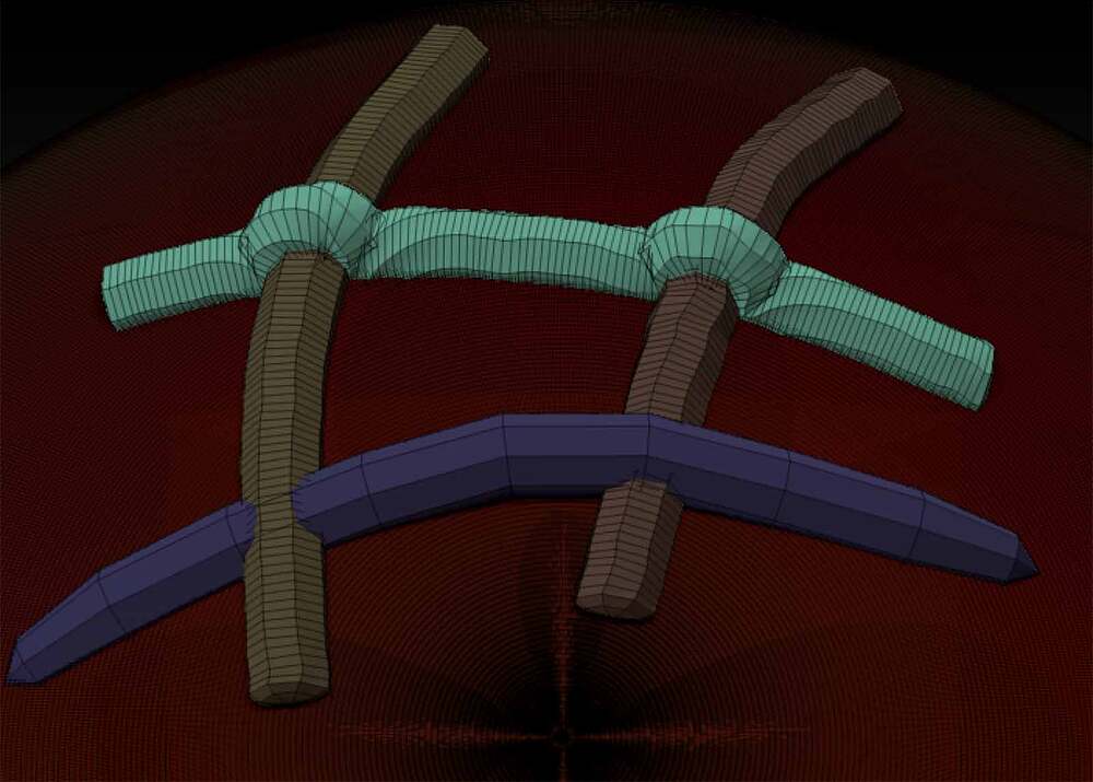 stiffness