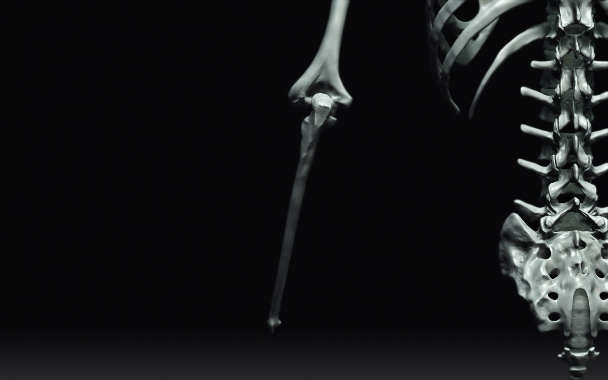 Ulna2