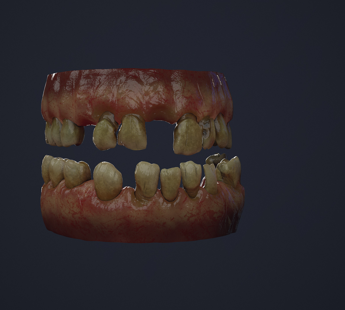 Teeth01.jpg