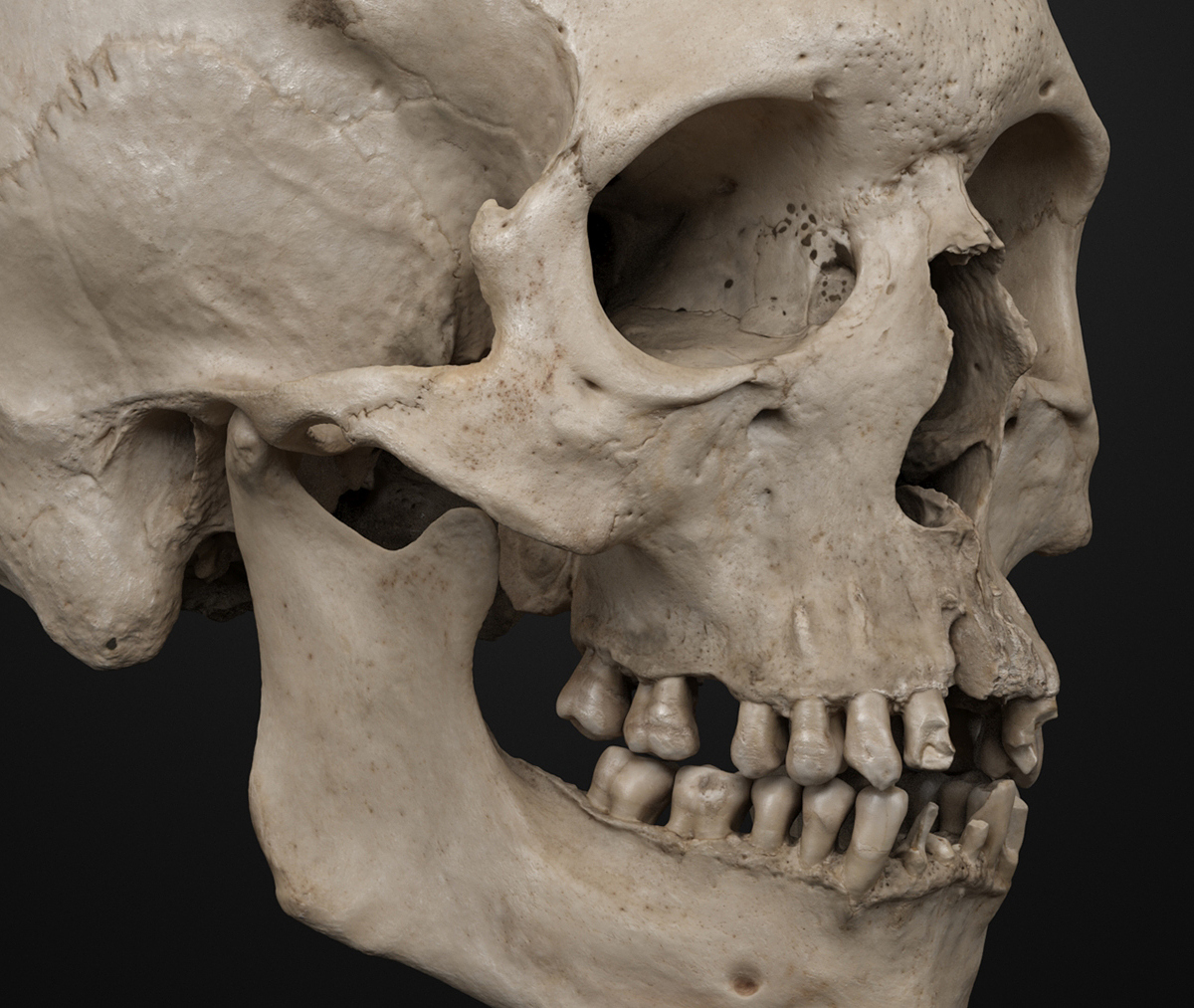 Real Human Skull 3d Scan Zbrushcentral