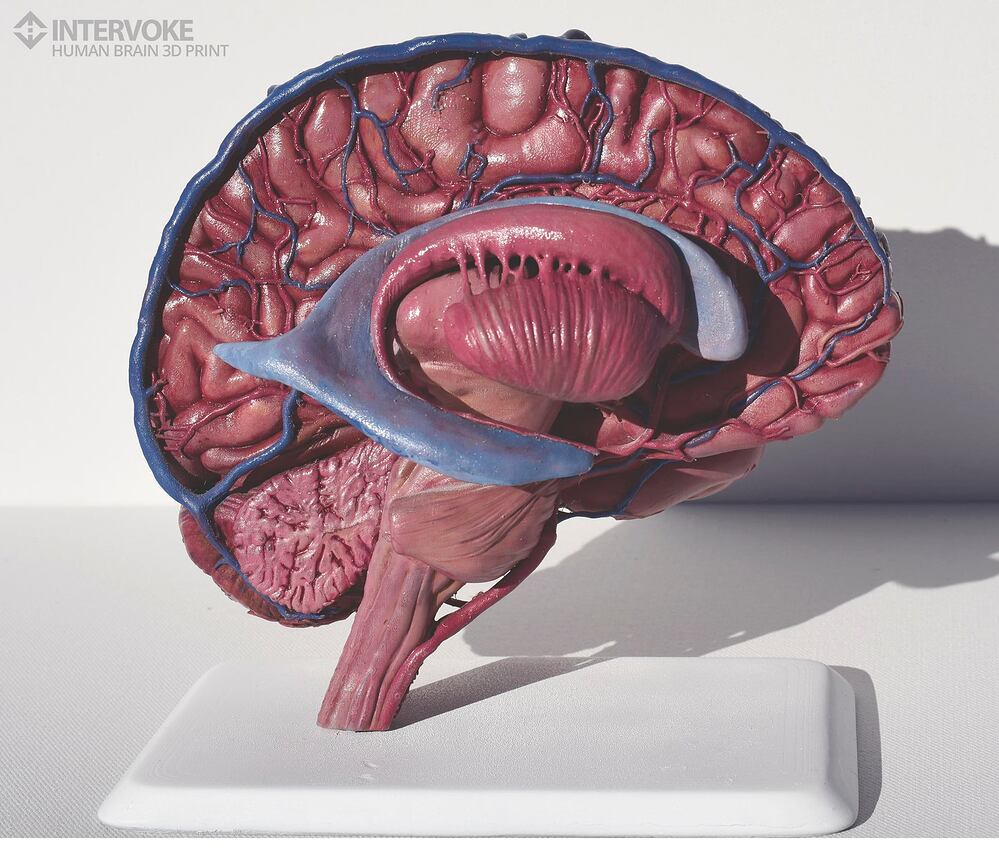 Intervoke_brain 3d print03