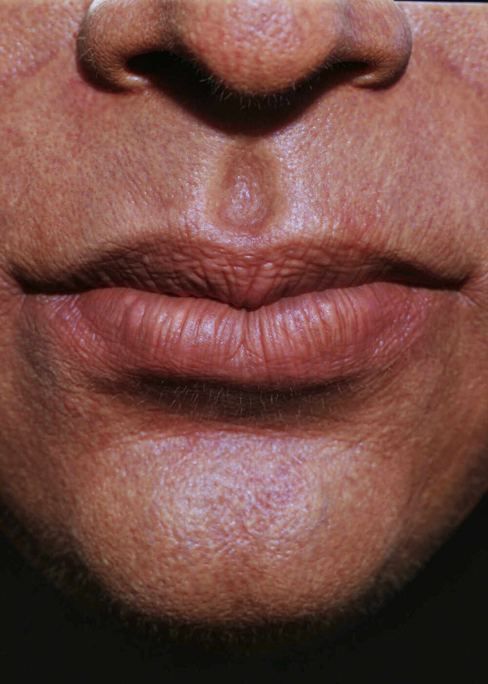 Lips_03
