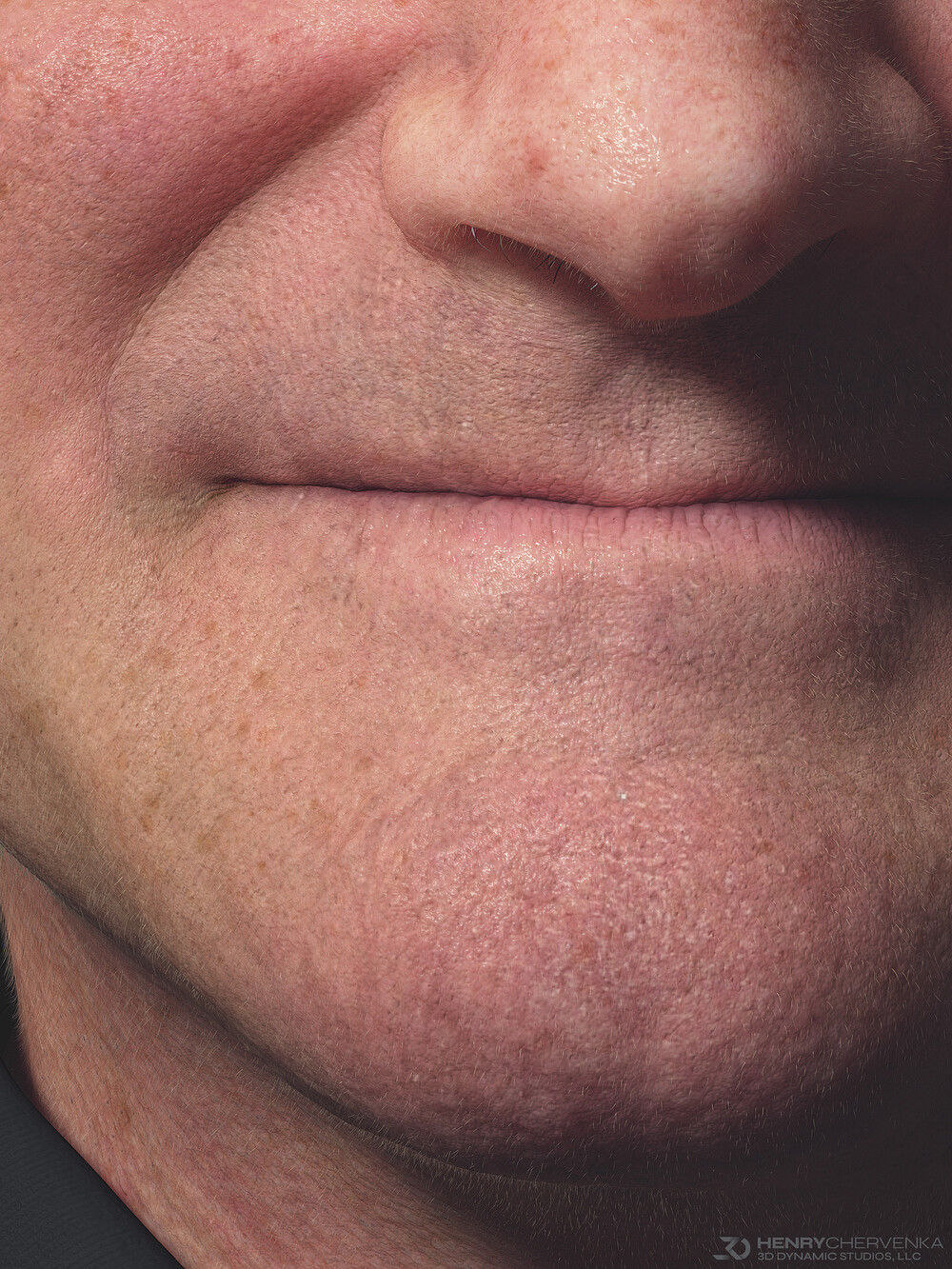 CloseUp