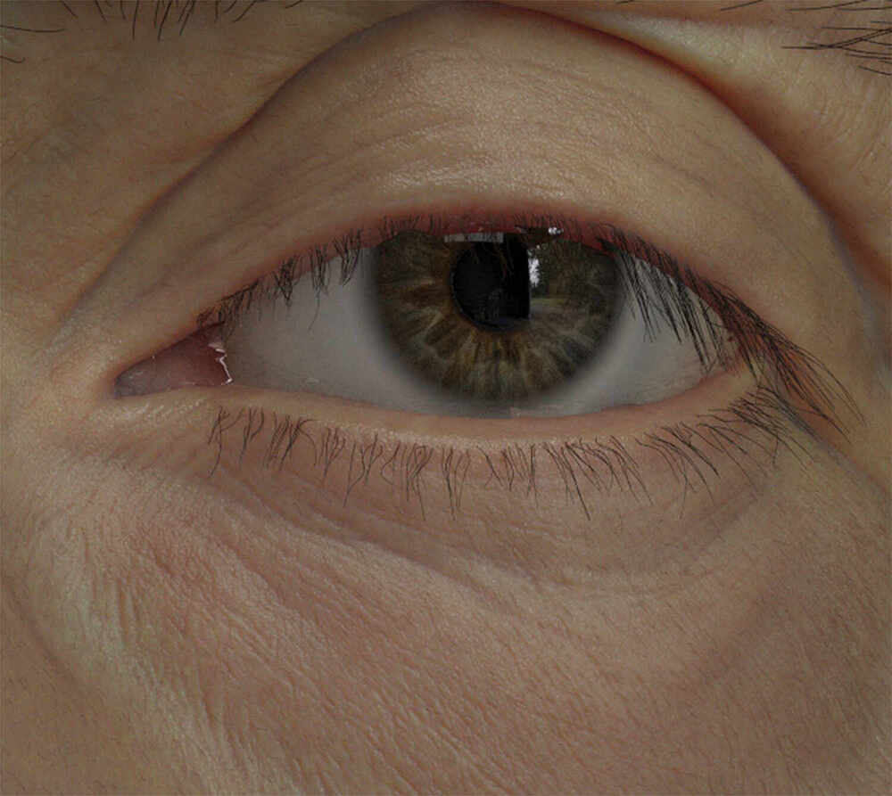 eye