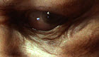 ZBCThumb2.jpg
