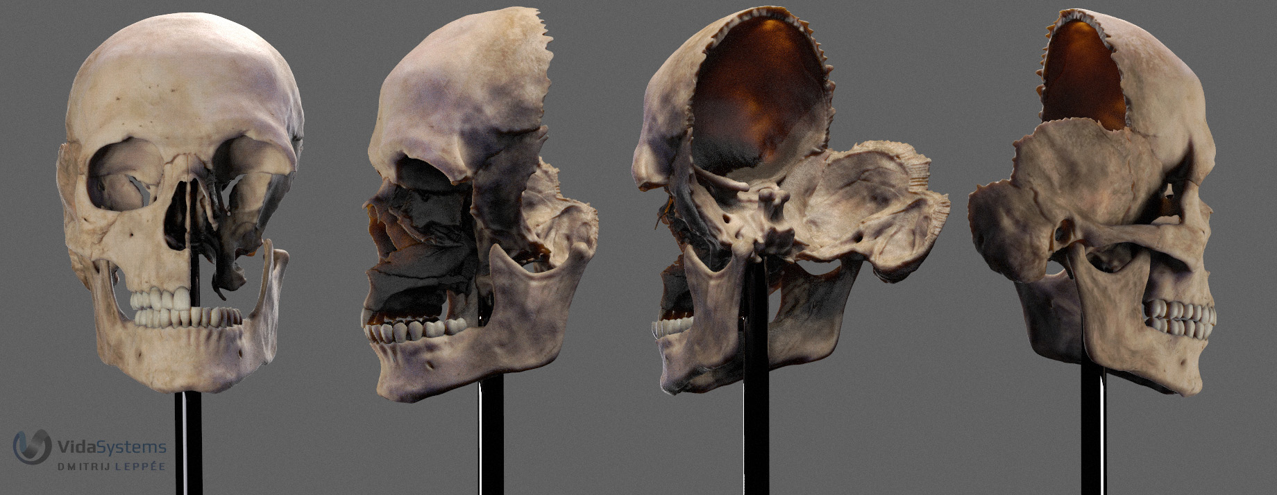 Vida_skull.jpg