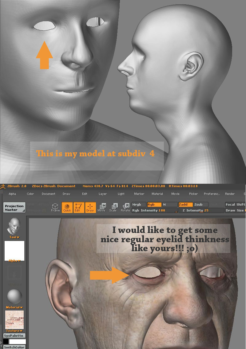 eyelid.jpg