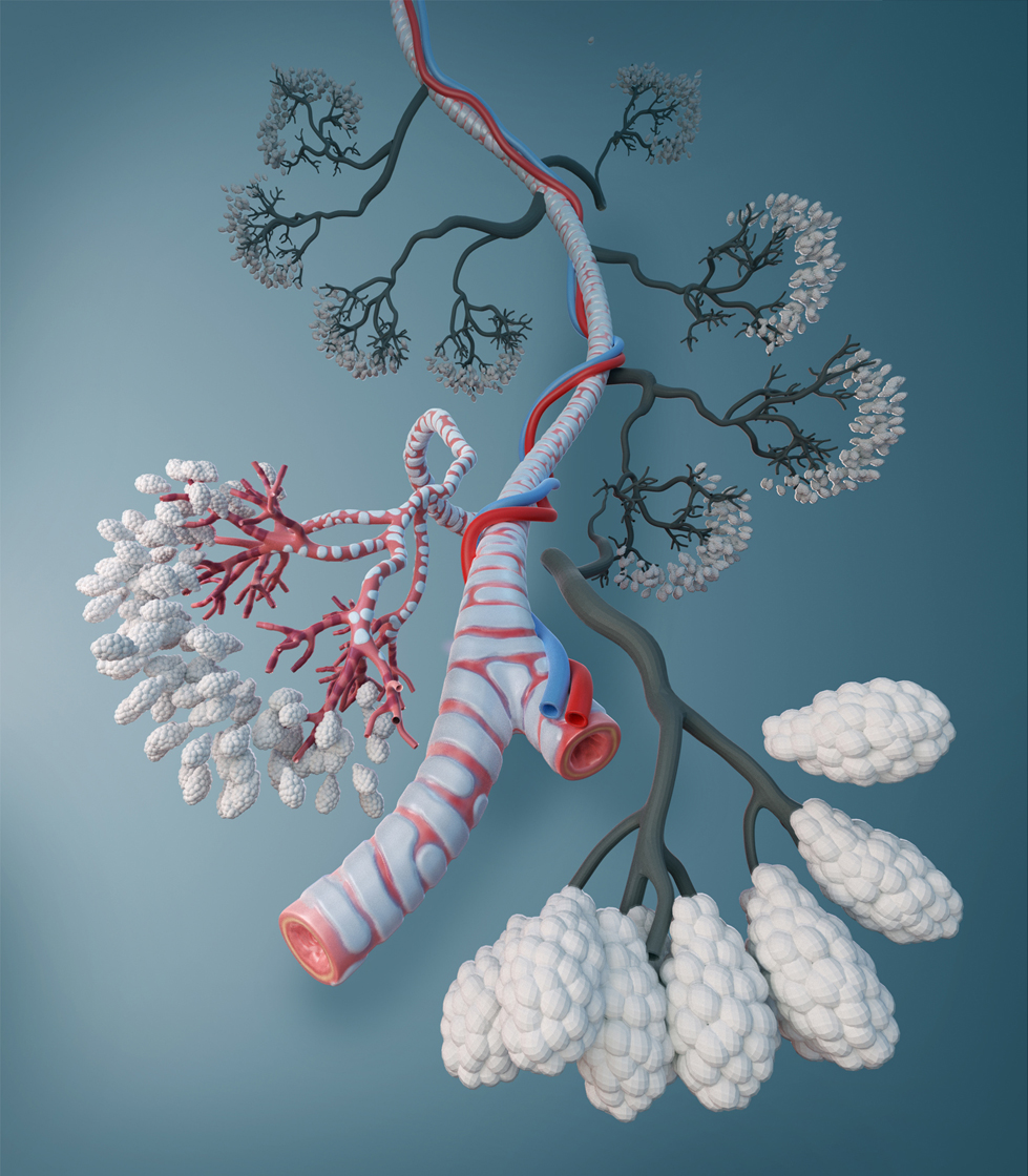 bronchiole-test1.jpg