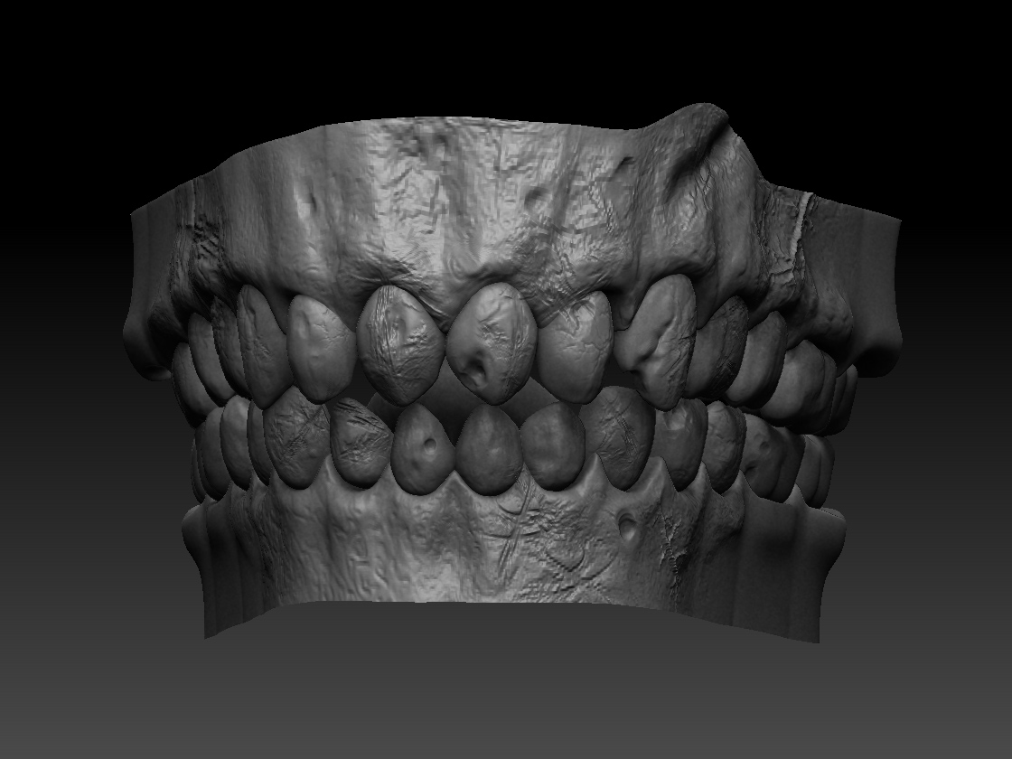 dente-e-gengiva.jpg