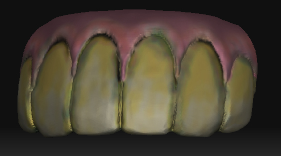 teeth.jpg