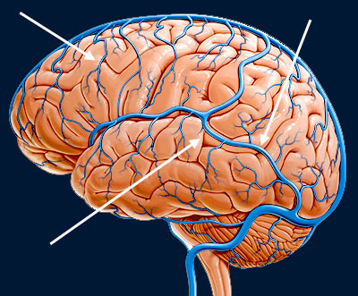 brain veins.jpg