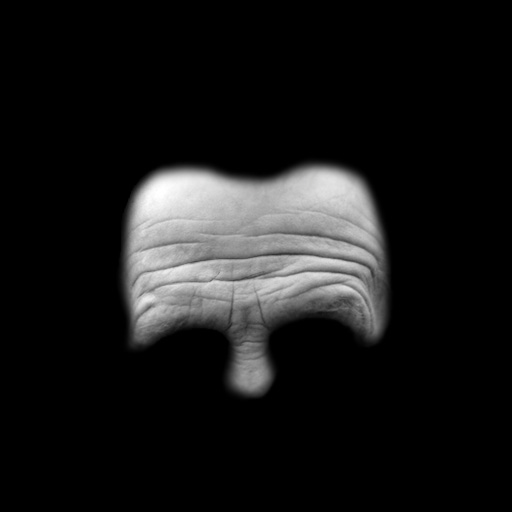 foreheadWrinkles.jpg