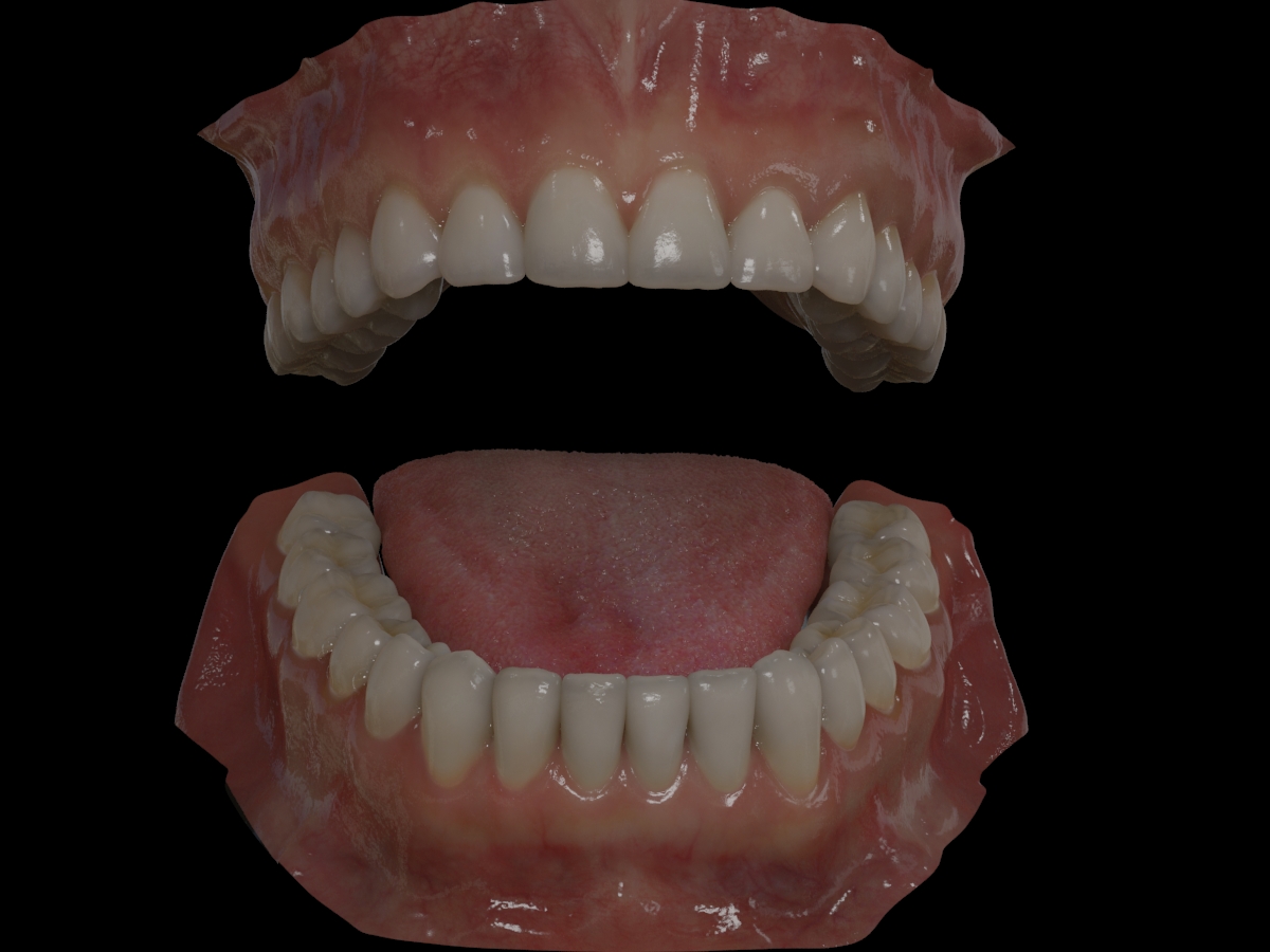 dents du bas 0357.jpg