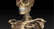 goldonskeletonthumb.jpg