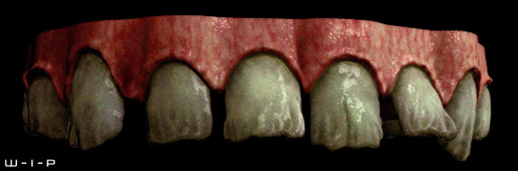 teethTest2.jpg