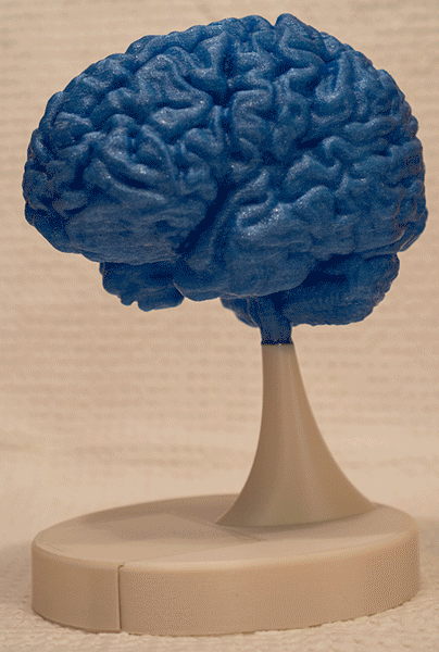 Brain_13.gif