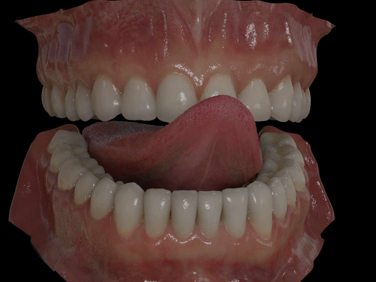 dents du bas 0366.jpg