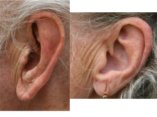 ears.jpg