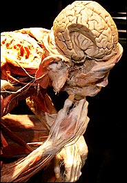 Cadaver.jpg
