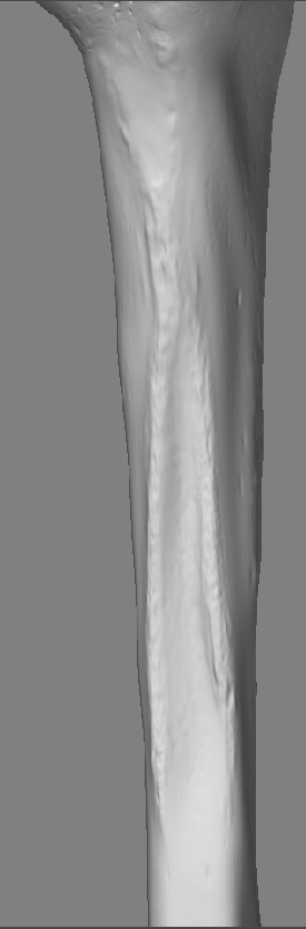 HumerusShaft_A_03.jpg