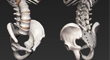 pelvis_thumb.jpg