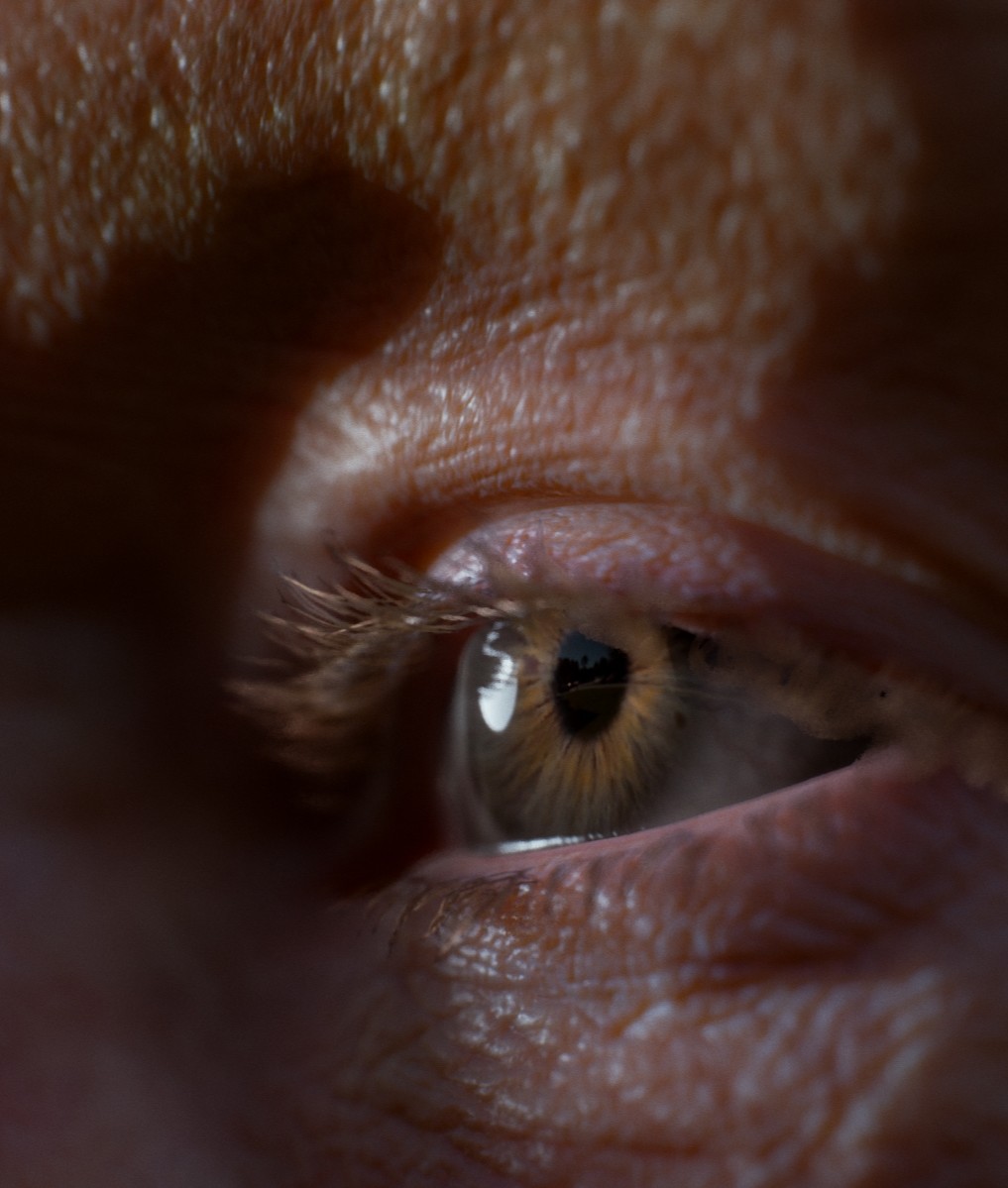 vimal-kerketta-eye-4.jpg?1486132510.jpg