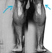 legjoint.jpg