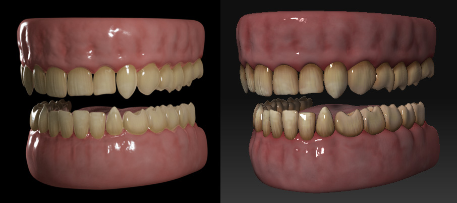 Teeth.jpg