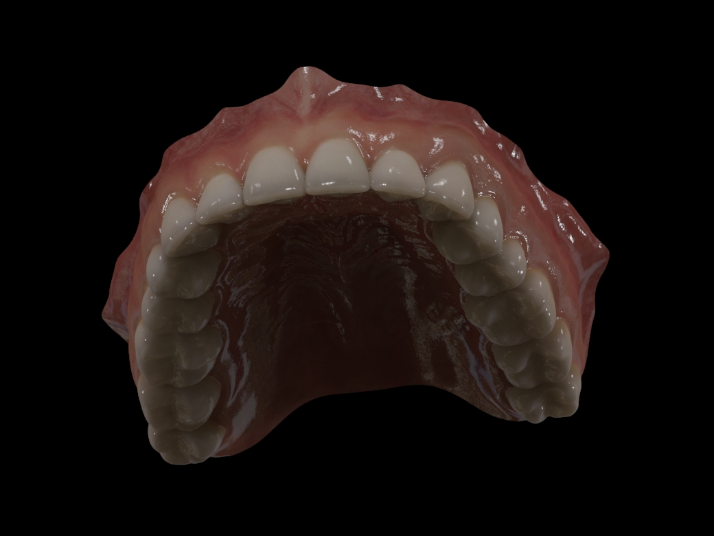dents du bas 0222.jpg