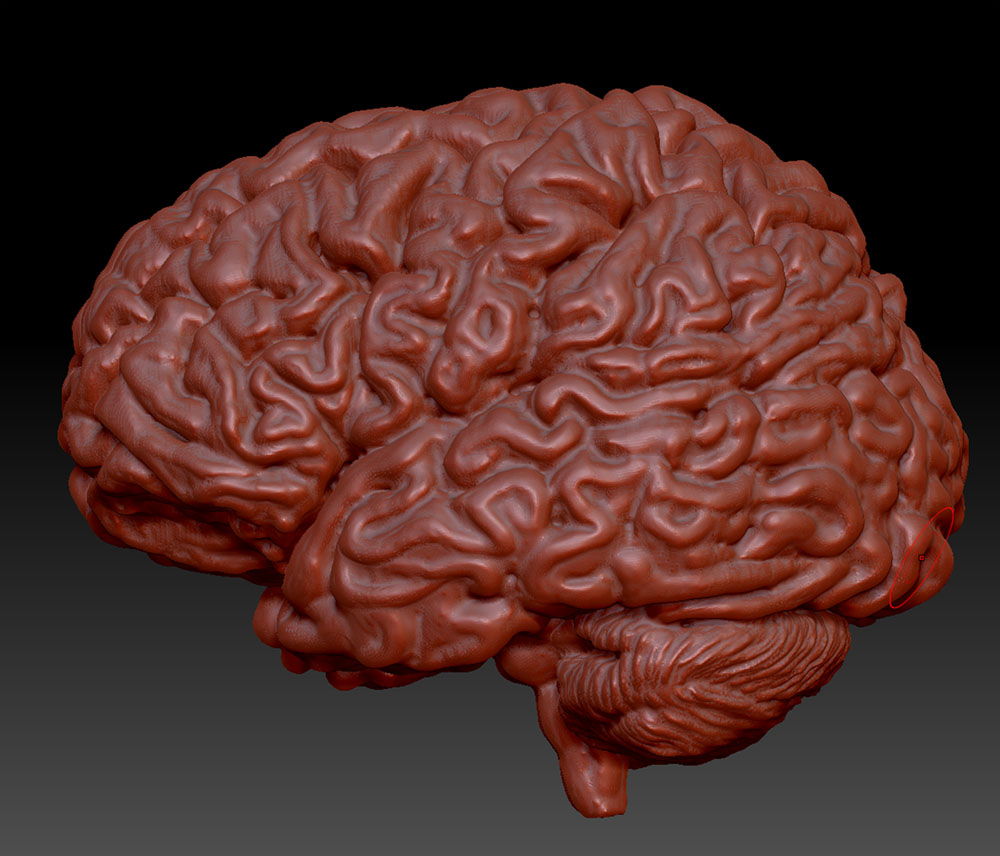 zBrain-2.jpg