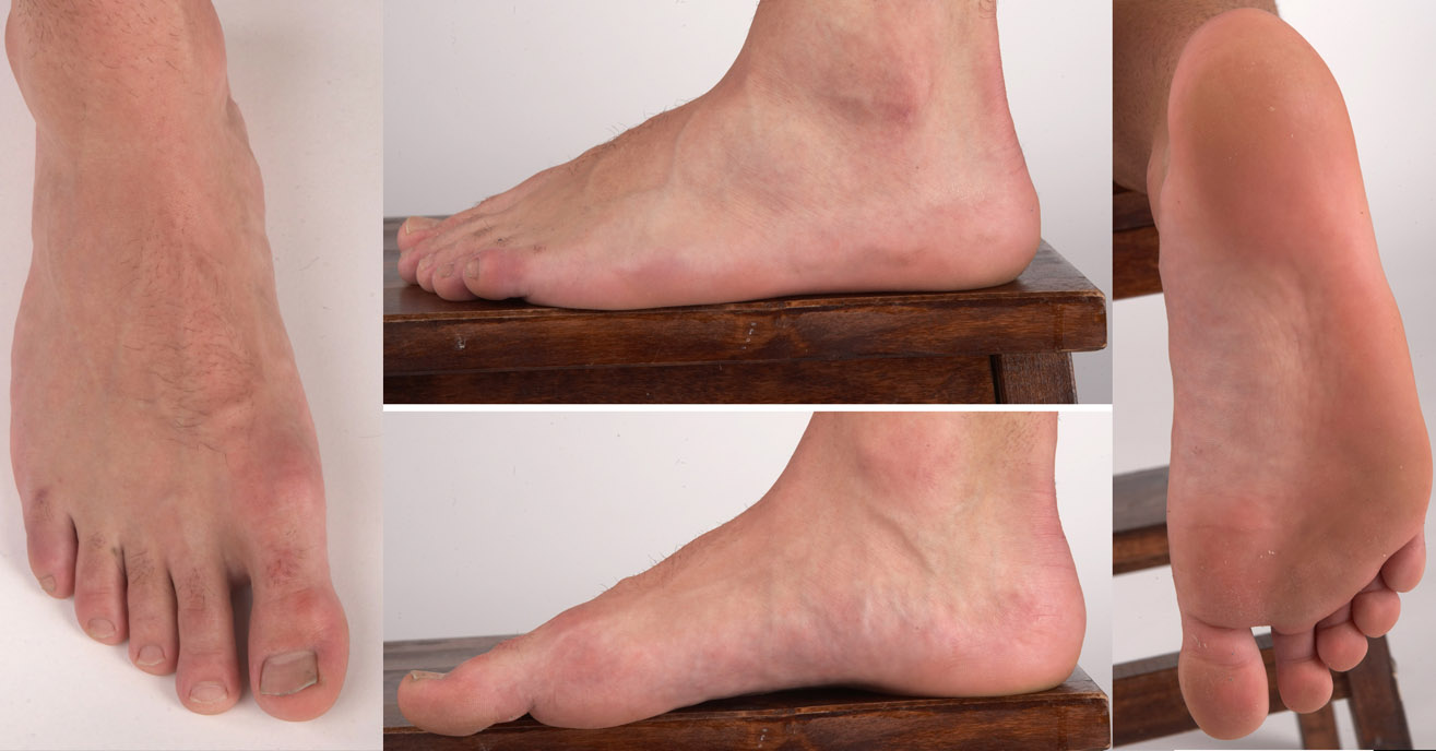 foot.jpg