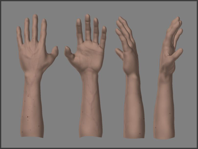 My Arm.jpg