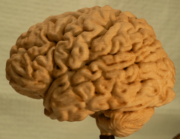 Brain_02.gif
