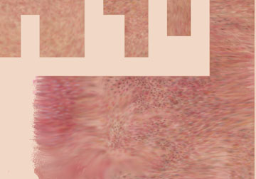 ALskin.jpg